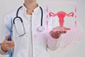 子宫内膜癌早期筛查技术